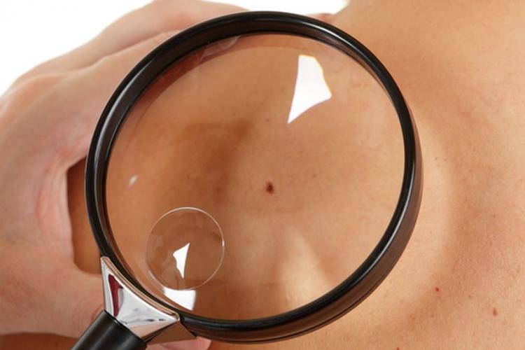 Visuel grain de beaute