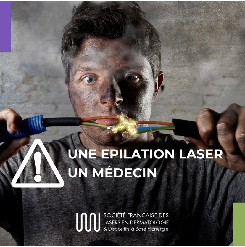 Une épilation laser, un médecin 