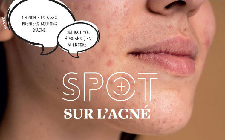 visuel spot sur l'acnée