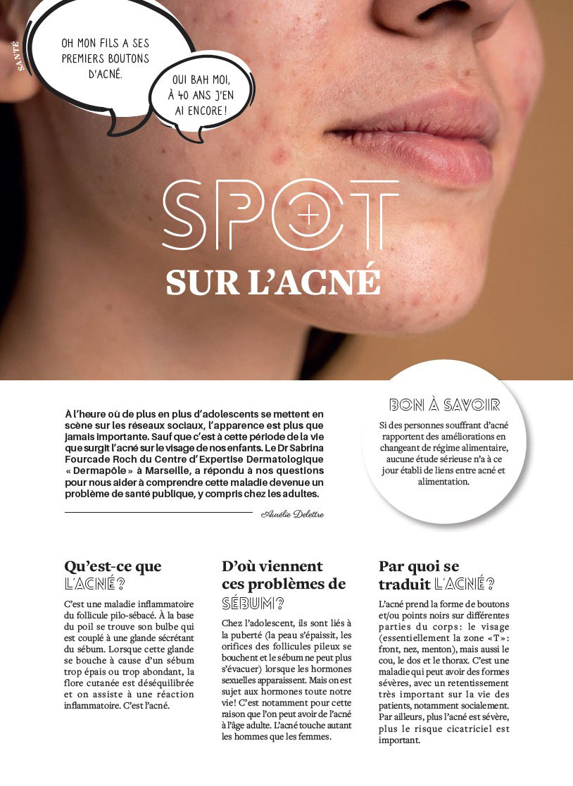 Spot sur l'acné | DERMAPOLE