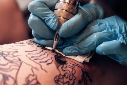 détatouage